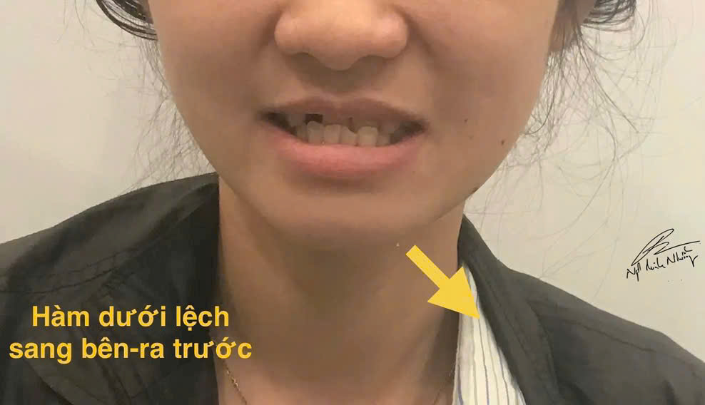 Niềng răng giúp cải thiện thẩm mỹ của hàm răng, giúp bạn tự tin hơn khi cười và giao tiếp. Một hàm răng đều đặn và đẹp giúp bạn cảm thấy tự tin hơn trong các tình huống xã hội, giao tiếp và công việc.